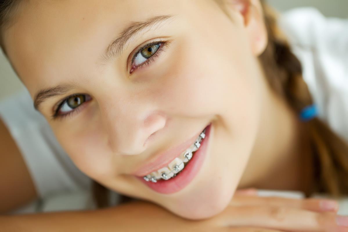 Traditional Braces  Medford, OR 